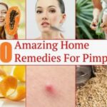 Home Remedies for Oily Skin and Pimples