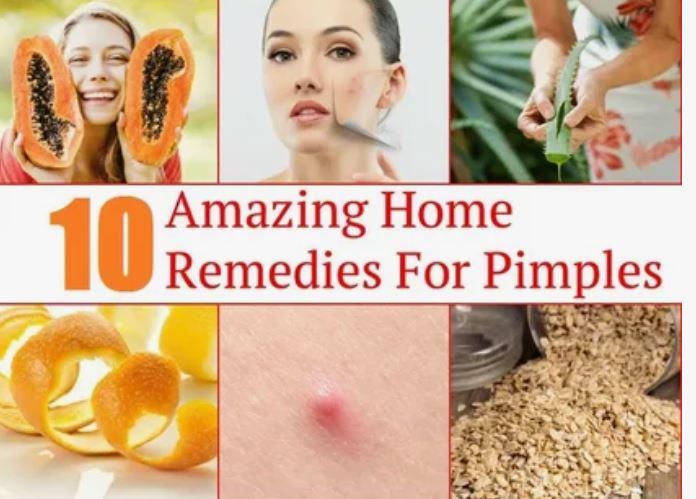 Home Remedies for Oily Skin and Pimples